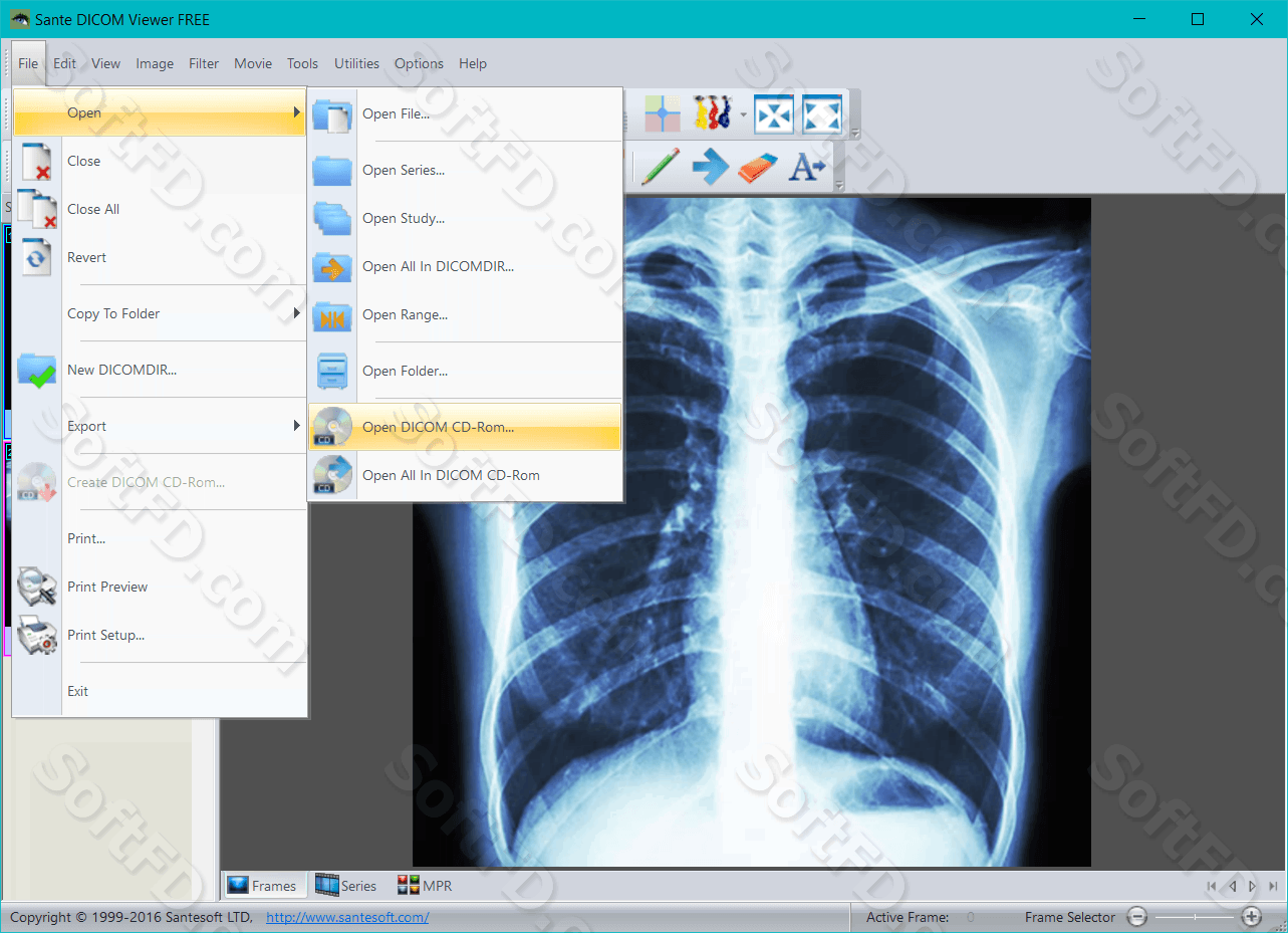 Sante DICOM Viewer Pro 12.2.5 free instal