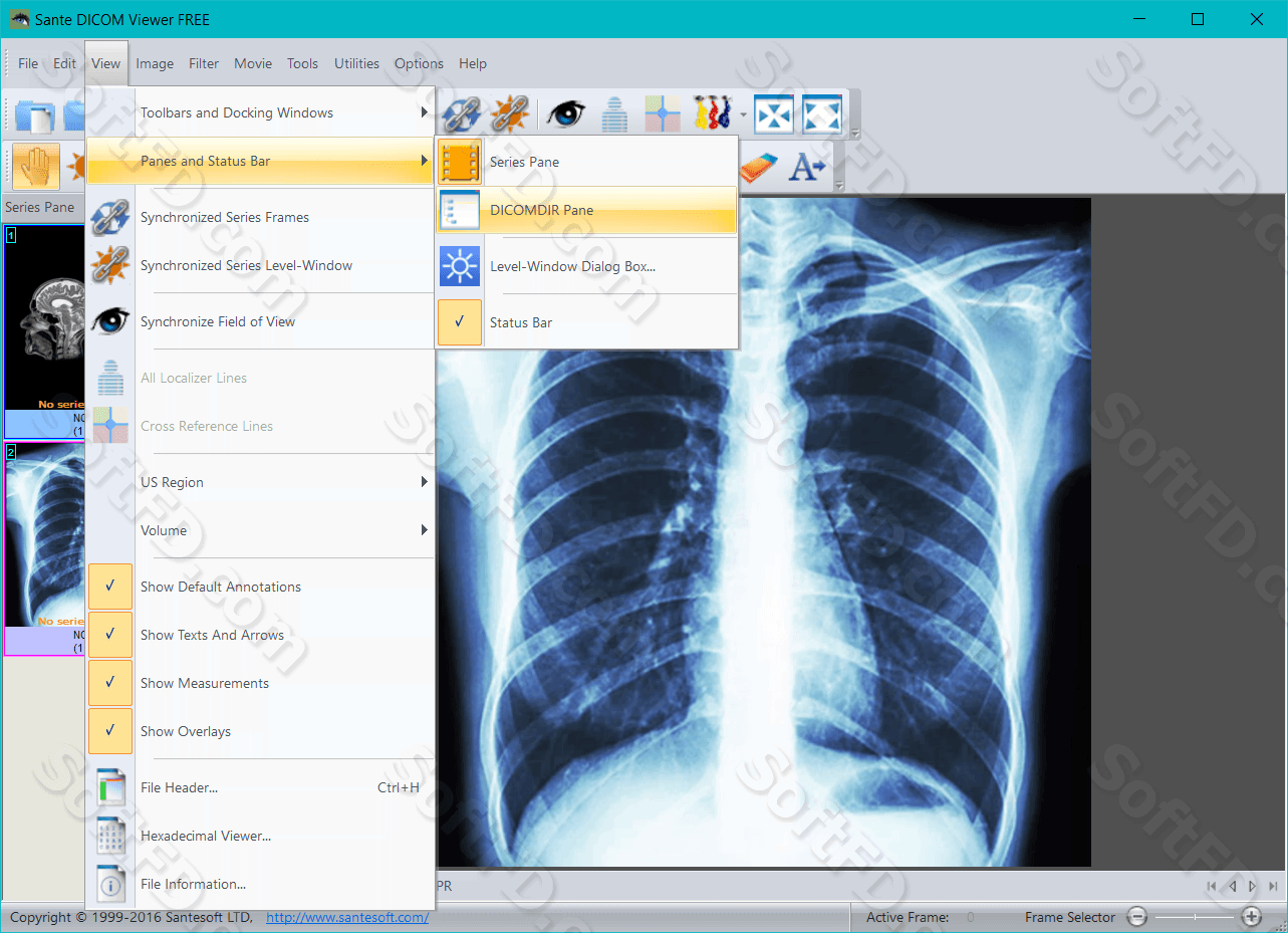 free instal Sante DICOM Editor 8.2.5